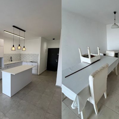 לפני אחרי- השקדים